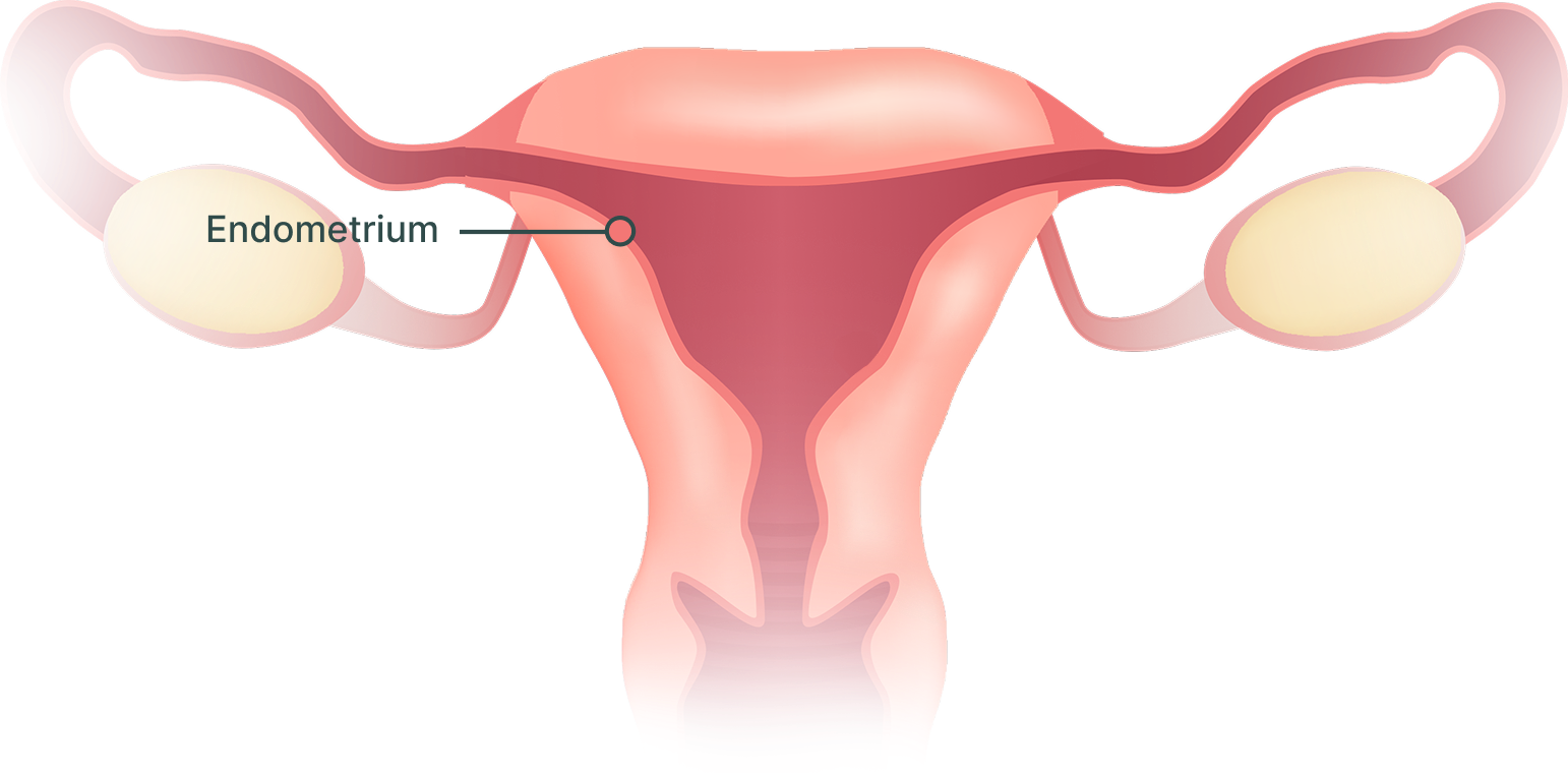 Diagram of the uterus with the endometrium, its inner lining, labeled.